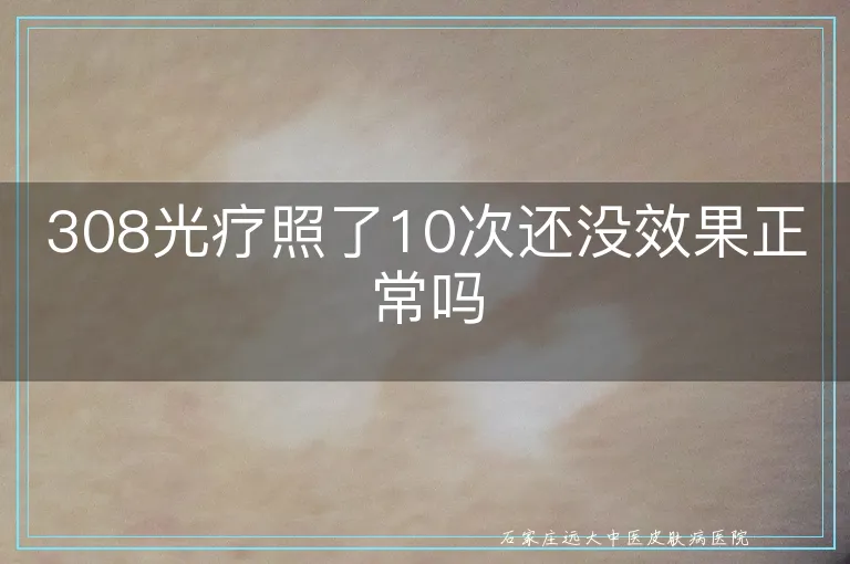 308光疗照了10次还没效果正常吗