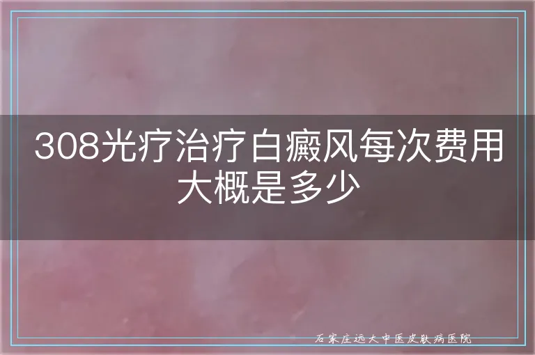 308光疗治疗白癜风每次费用大概是多少