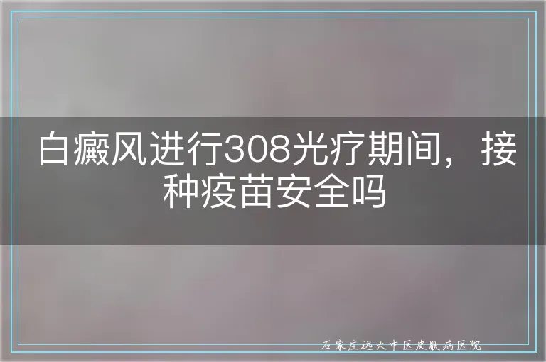 白癜风进行308光疗期间,接种疫苗安全吗