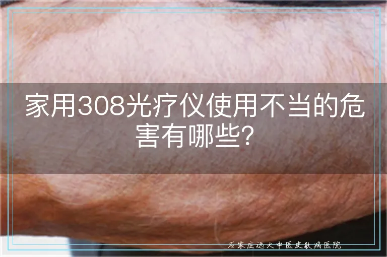 家用308光疗仪使用不当的危害有哪些?