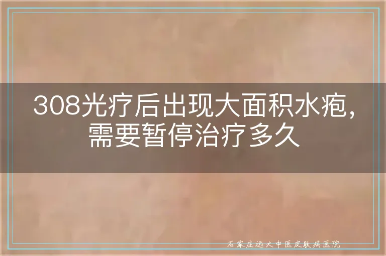 308光疗后出现大面积水疱,需要暂停治疗多久
