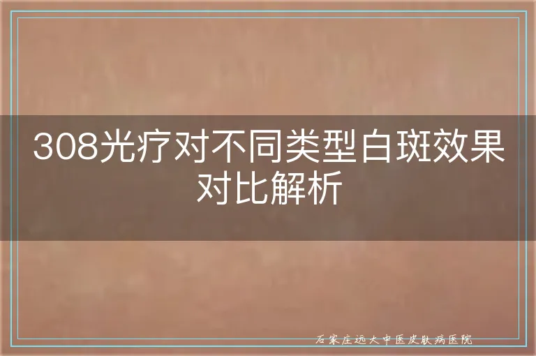 308光疗对不同类型白斑效果对比解析