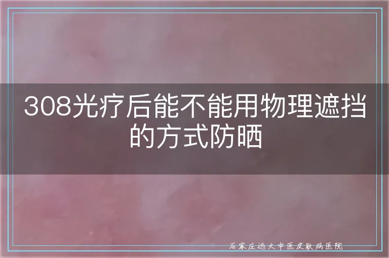 308光疗后能不能用物理遮挡的方式防晒