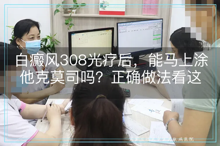 白癜风308光疗后,能马上涂他克莫司吗?正确做法看这里