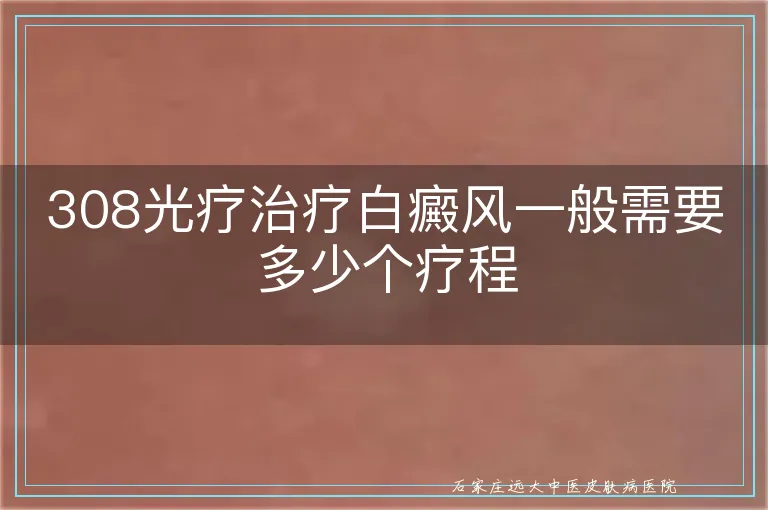 308光疗治疗白癜风一般需要多少个疗程